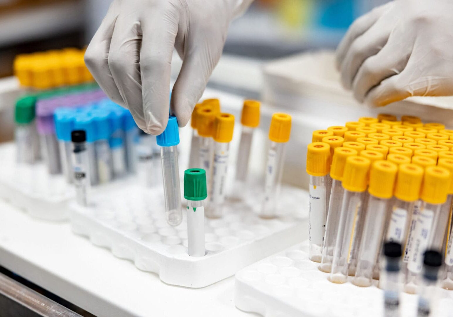 Close-up on a healthcare worker handling blood samples in the laboratory at the hospital