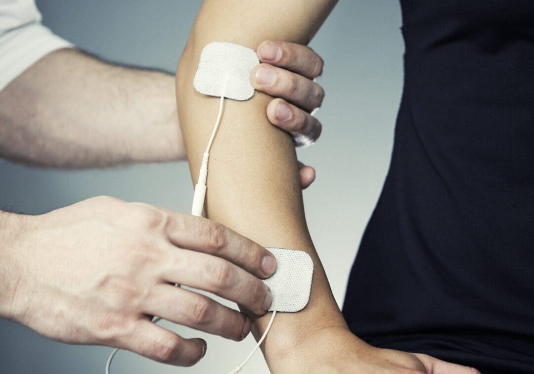 Physical therapist positioning TENS electrodes on lower arm